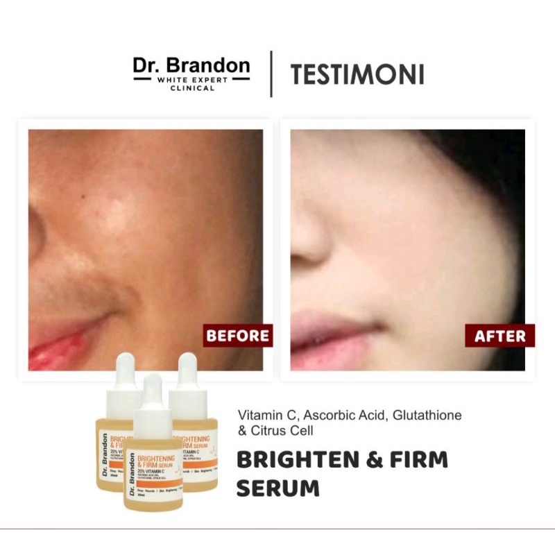 Serum Dr brandon Vitamin C 20% Brightening &amp; Firming Serum