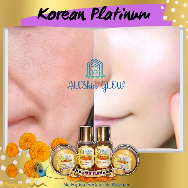 KOREAN PLATINUM ALESKIN GLOW Skincare Glowing-Paket Perawatan Wajah Korea-Cream Glowing