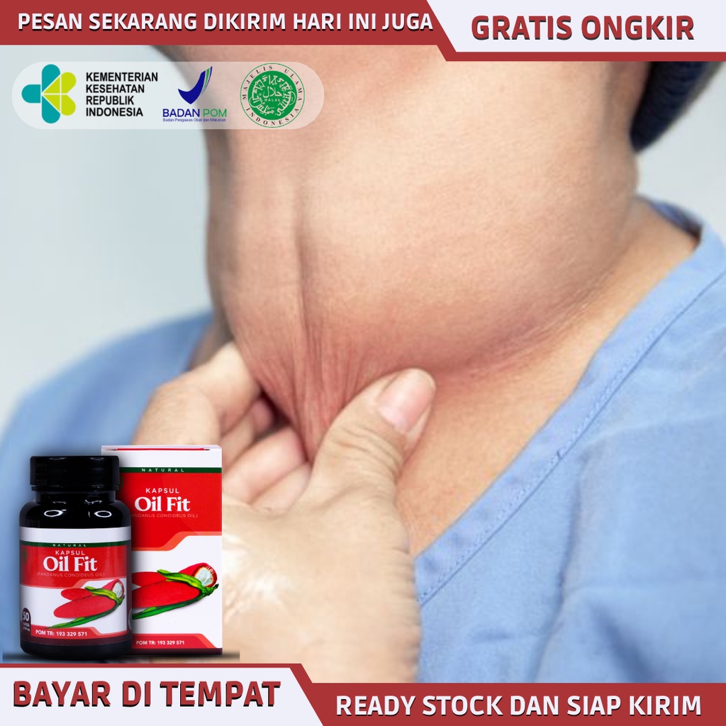 Obat sakit gondok, obat kelenjar tiroid, obat peradangan pada kelenjar tiroid, obat herbal benjolan 