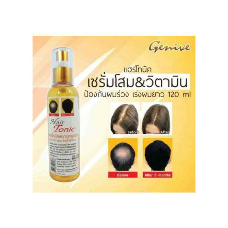 (READY) GENIVE HAIR TONIC Penyubur Rambut ORIGINAL THAILAND