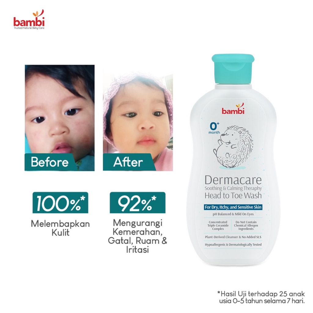 Bambi Dermacare Soothing &amp; Calming Theraphy Head To Toe Wash Sabun Shampoo Anak Bayi 200ml