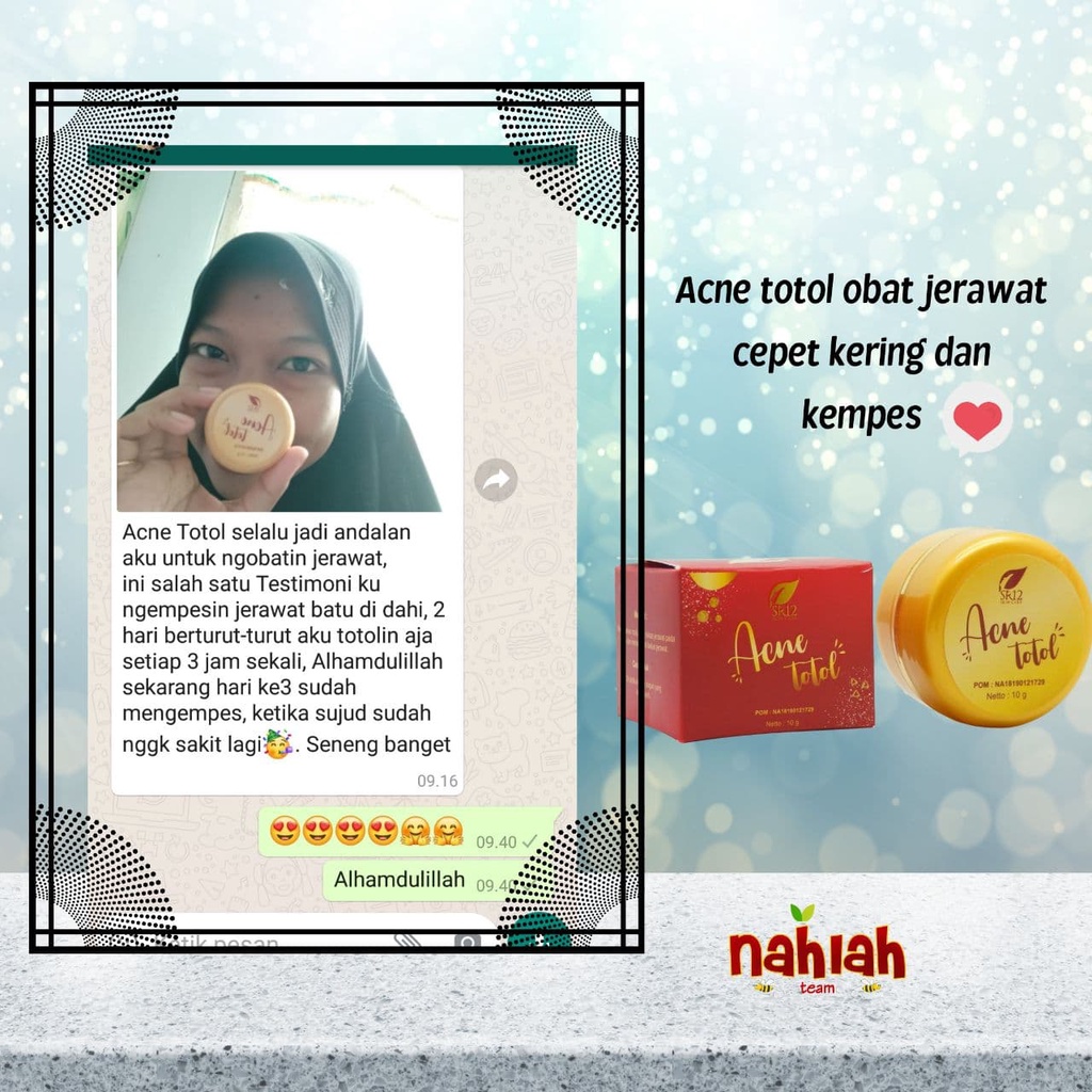 Acene Totol SR12 SR 12 Cream Krim Obat Oles Perawatan Penghilang Pembersih Jerawat Dan Bekas Jerawat BPOM Ampuh