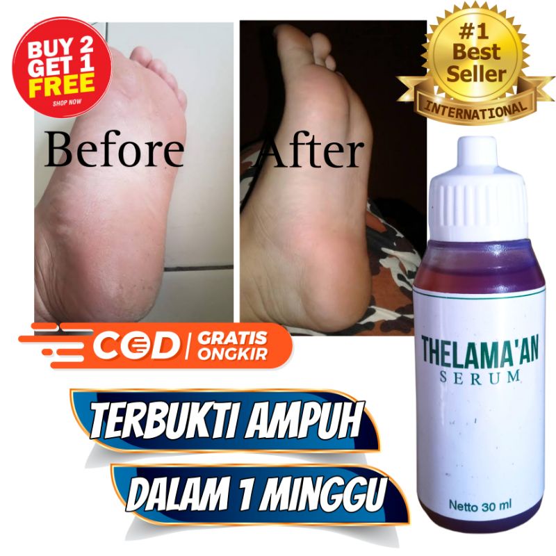 ORIGINAL THELAMA'AN SERUM obat kaki pecah pecah dan kapalan paling ampuh.