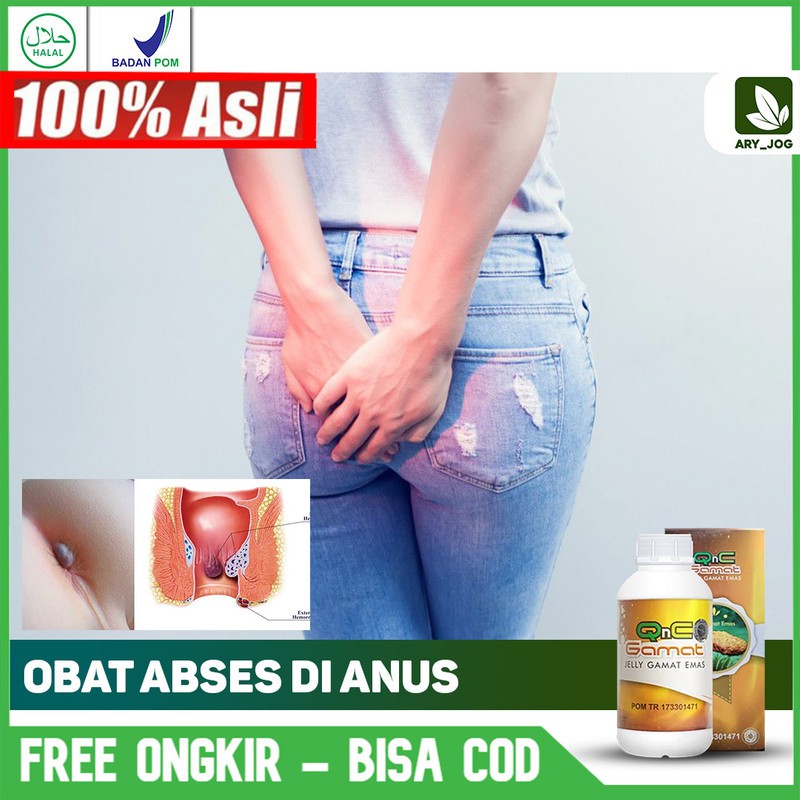 Obat Abses Anus, obat abses Terlaris No.1 Qnc Jelly Gamat Terbukti Aman sembuhkan abses anus
