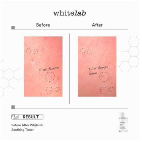 WHITELAB Brightening Face Toner | Soothing Toner | White Lab