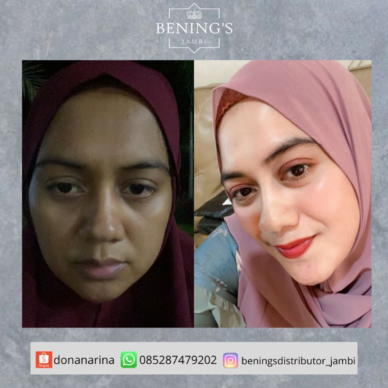 Benings Skincare Brightening Dr. Oky Pratama *FREE GIFT* | Bening’s indonesia Bening’s clinic