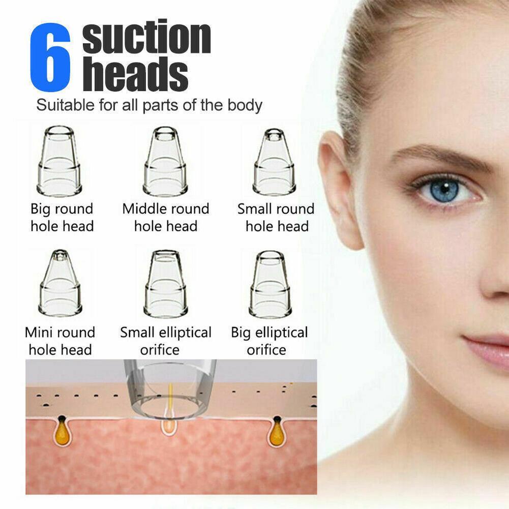 Blackhead Remover Household Electric Blackhead Cleaner Electric with 3 Level Smooth (Beauty Tools)