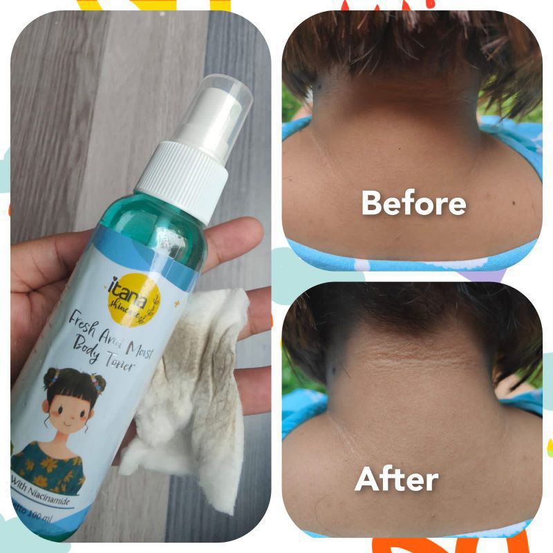 TONER BADAN ITANA BPOM ORI