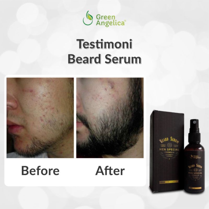 GEEEN ANGELICA BEARD SERUM ORIGINAL - SERUM PENUMBUH BULU RAMBUT, ALIS, JENGGOT, KUMIS