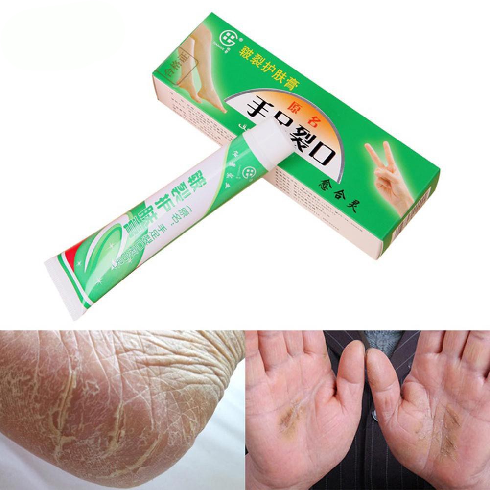 salep kaki pecah tumit dan kering cream hebal