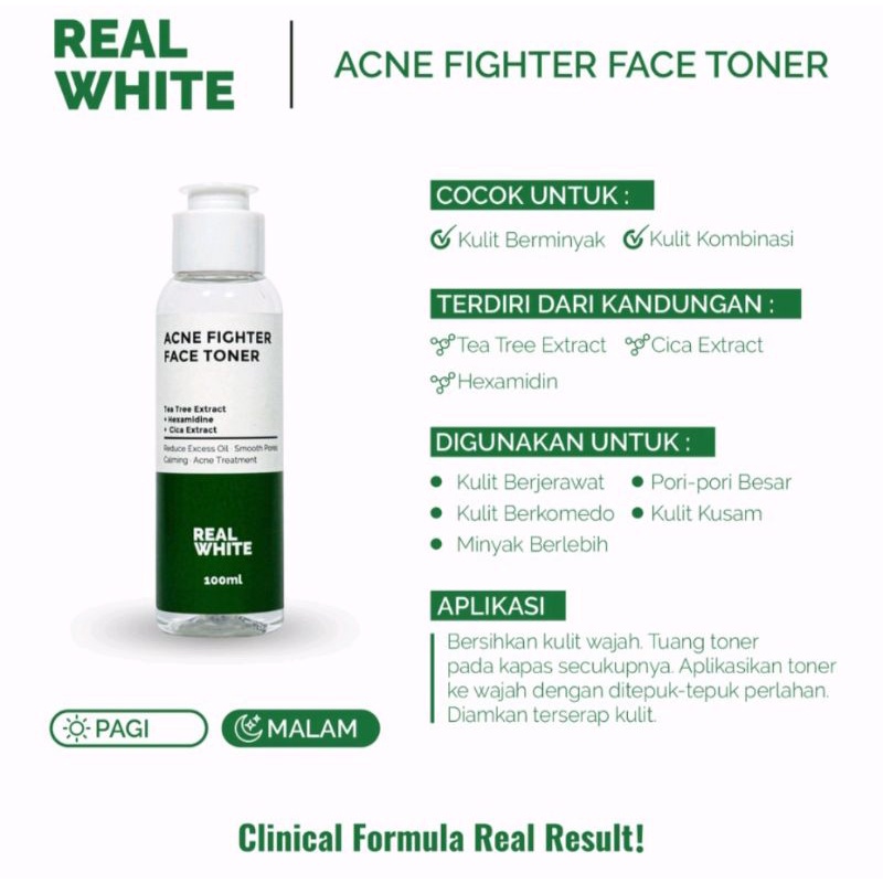 Real white acne fighter face toner/tea tree extract 100ml