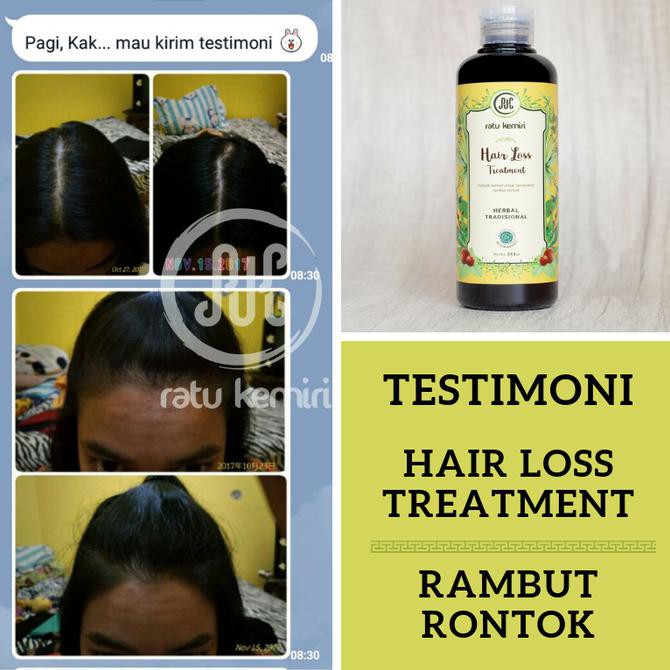 Lefg Minyak Kemiri Obat Rambut Rontok Alami Ratu Kemiri Ukuran 100ml Tuzh Shopee Indonesia