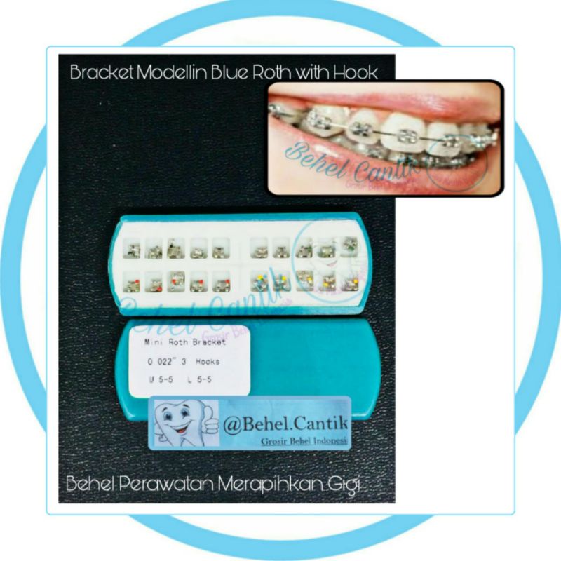 Bracket Modellin Roth (behel perawatan merapihkan gigi)