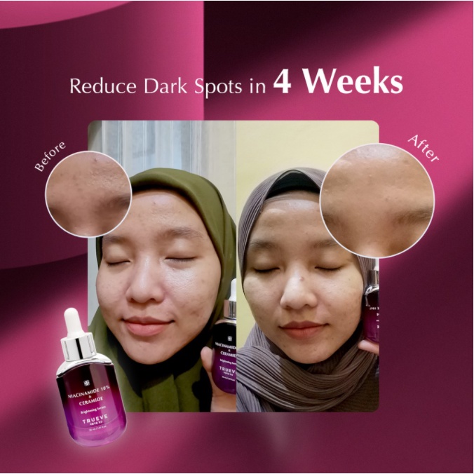 [TERMURAH] TRUEVE Acne Brightening Anti Aging Hydrating Serum Toner &amp; Facial Wash