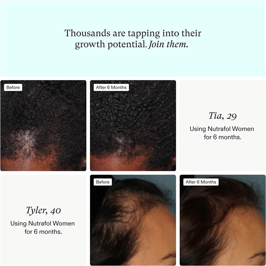 NUTRAFOL Women 120 Kapsul - Hair Growth Supplement - Original-3
