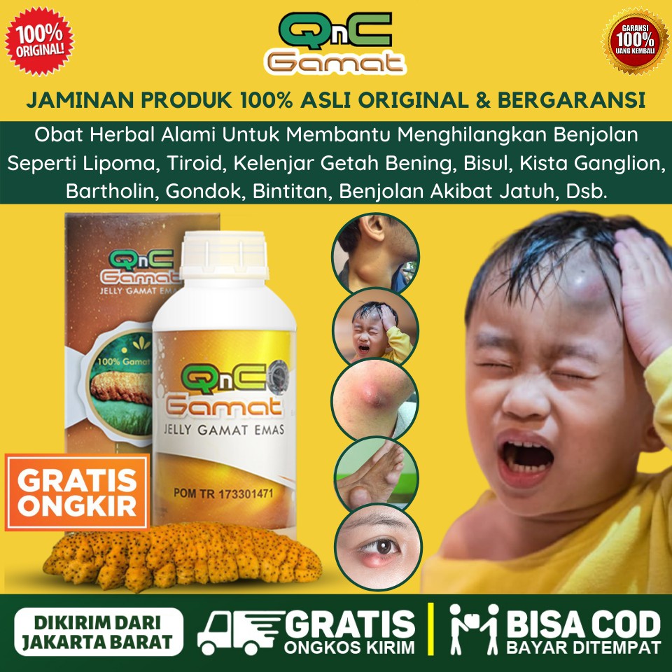 Obat Bisul Di Kepala Untuk Anak Bayi Dan Orang Dewasa Bisulan Pada Kelopak Mata Atas Belakang Pecah Shopee Indonesia