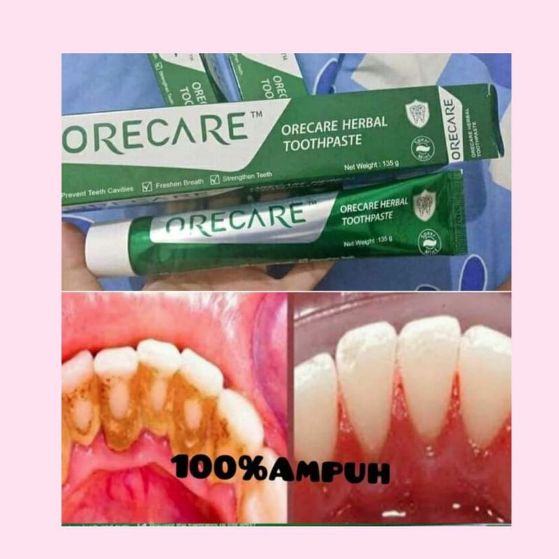 ODOL ORECARE PEMUTIH GIGI | BISA COD