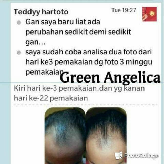 Green Angelica Combo 2 paket perawatan rambut berhijab anti rontok dan lepek teruji cepat & halal