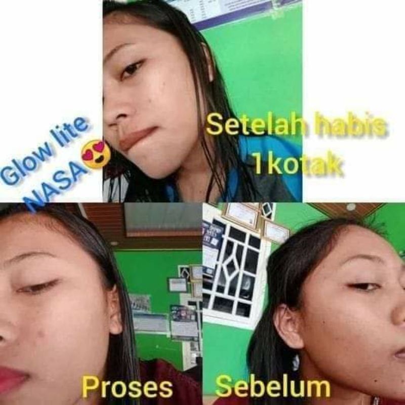 MORESKIN CLEAN AND GLOW LITE