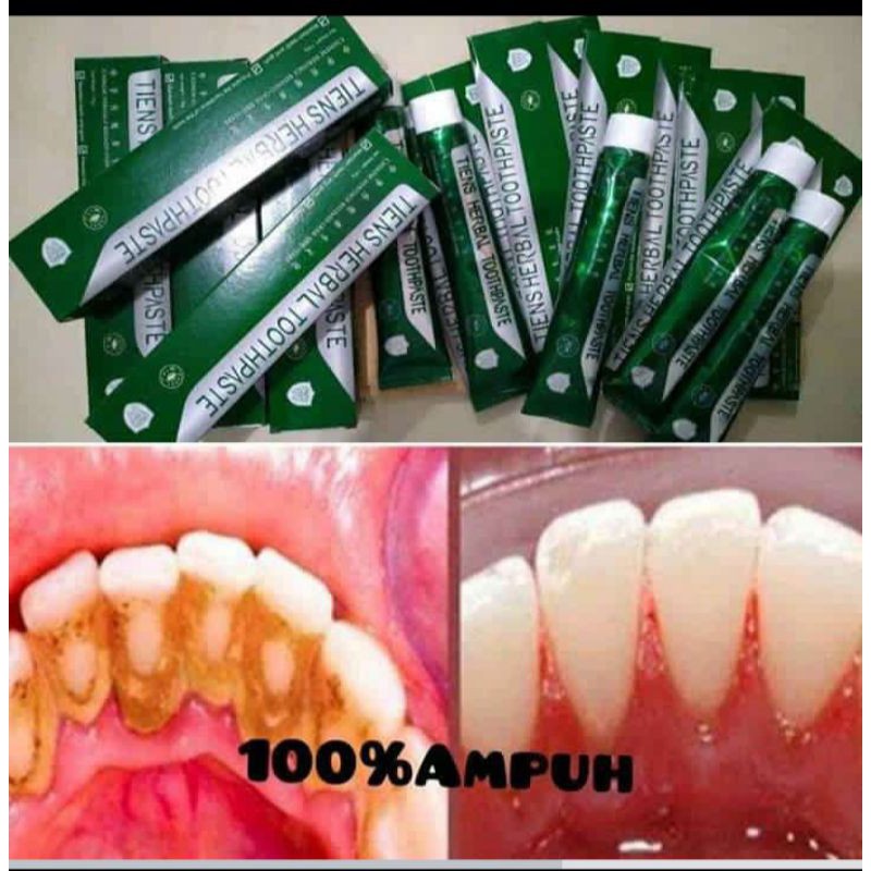 TERVIRAL ODOL PENGHILANG KARANG GIGI DAN PEMUTIH GIGI(BAYAR DITEMPAT)