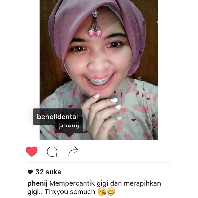 BRACKET BEHEL GIGI METAL AMPLOP YELLOW KUNING ORIGINAL - Kawat Dental Untuk Perbaikan Gigi - Mini Edgewise 0.22 Slot bukan Roth