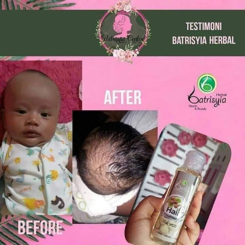 Baby hair treatment/ Penumbuh rambut anak/melebatkan rambut/menghitamkan rambut bahan alami bpom