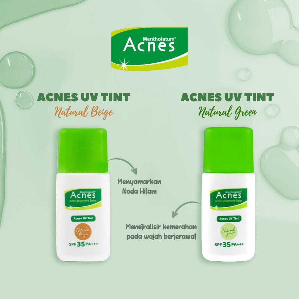 Acnes Natural Care Treatment Series mengatasi jerawat