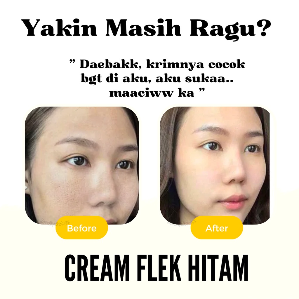 Cream Penghilang Flek Hitam Krim Serum Membandel Bpom White Neng Untuk Salep Salap Di Wajah Ampuh Crem Menghilangkan Noda Hitam Dan Jerawat Pria Dan Wanita Original