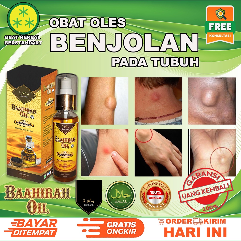 [MINYAK OLES BAAHIRAH]mengatasi -BENJOLAN - Tumor -Uci Uci dll