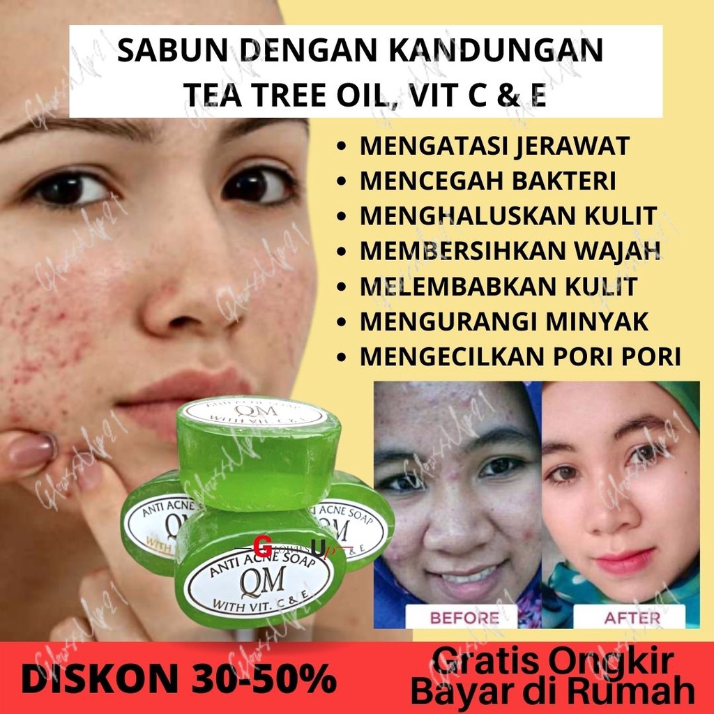 SABUN KHUSUS WAJAH DAN TUBUH BERJERAWAT QM FACIAL SOAP FOR ACNE SKIN BPOM - SABUN QM ANTI ACNE