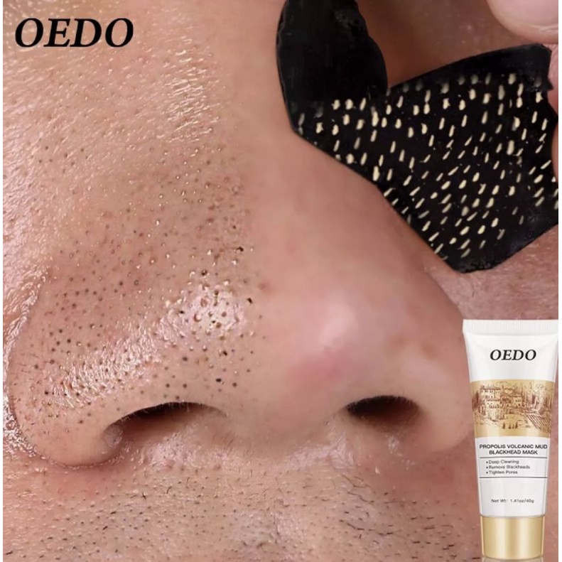 OEDO VOLCANIC SOIL FACIAL ACNE REMOVE BLACKHEAD MITE PROPOLIS FACE CARE PEMBERSIH KOMEDO BLACKHEAD-60ml