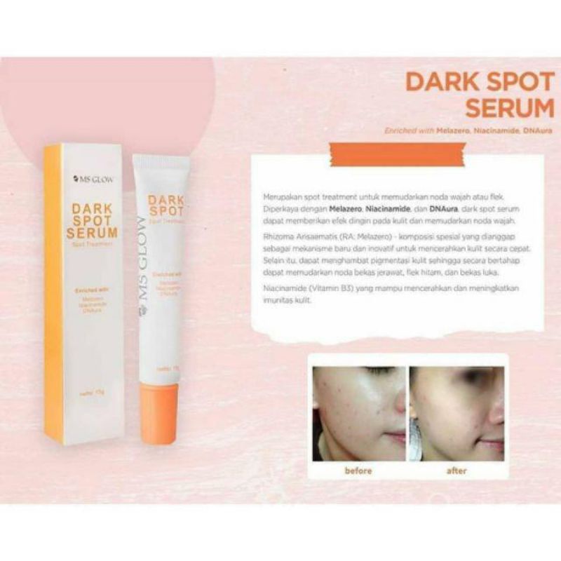 Ms GLow Spot Treatment, Pore Away, Dark Spot , Acne Spot MsGLow