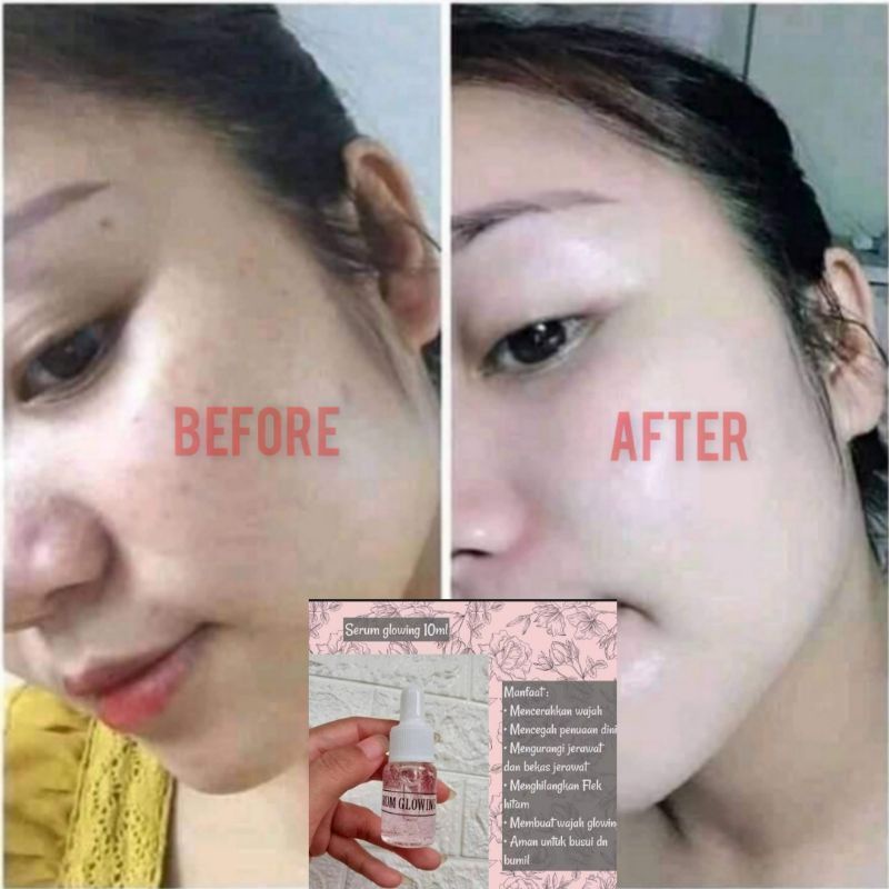 Aschosme SERUM Whitening GLOWING ~ Serum Bopeng