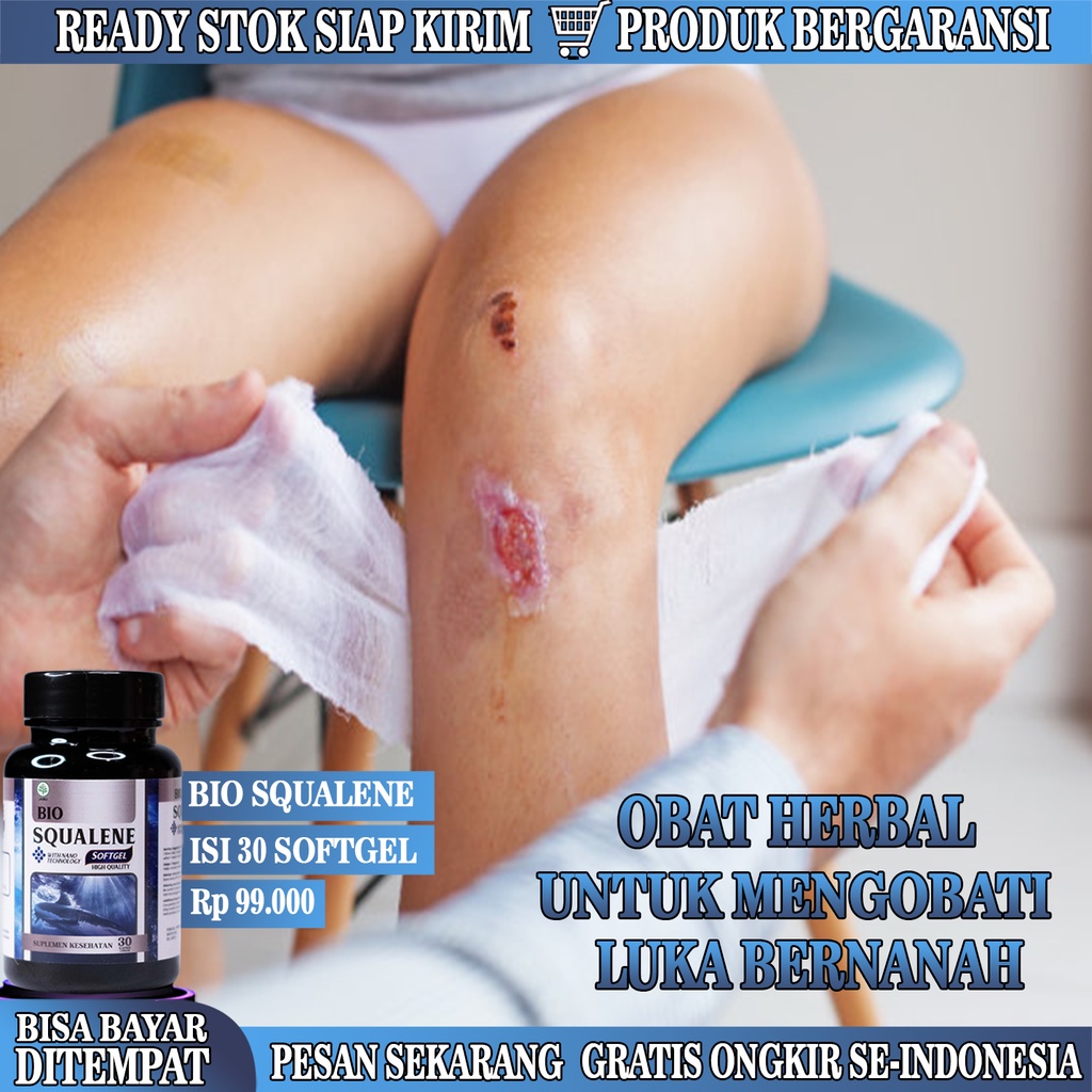 Obat Luka Bernanah, Obat Koreng Bernanah, Obat Borok Bernanah, Obat Herbal Pengering Luka Bernanah A