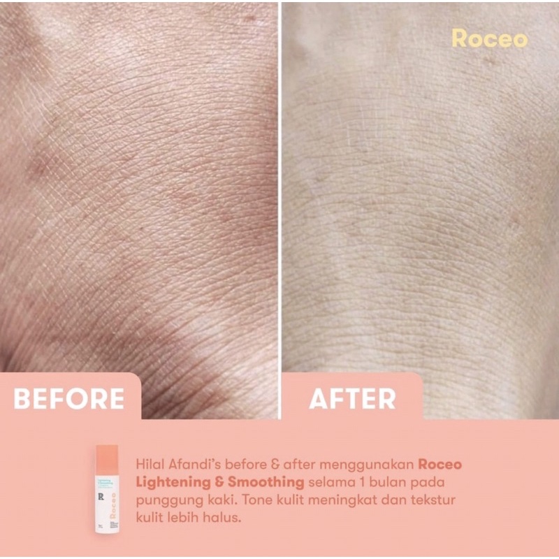 ROCEO UNDERARM SERUM 15ml