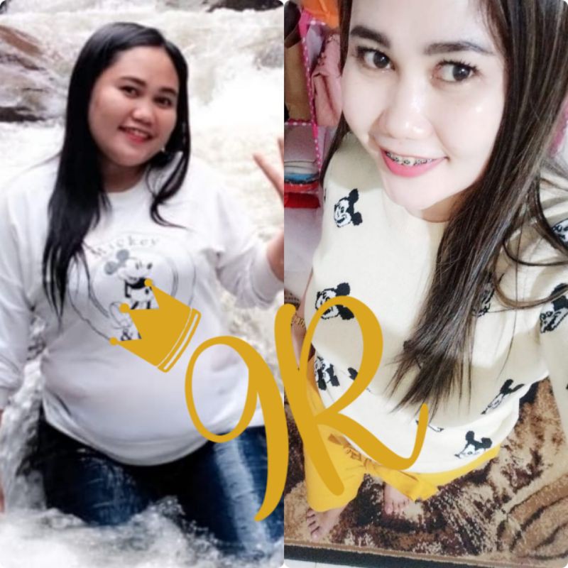 Kapsul pelangsing 9R