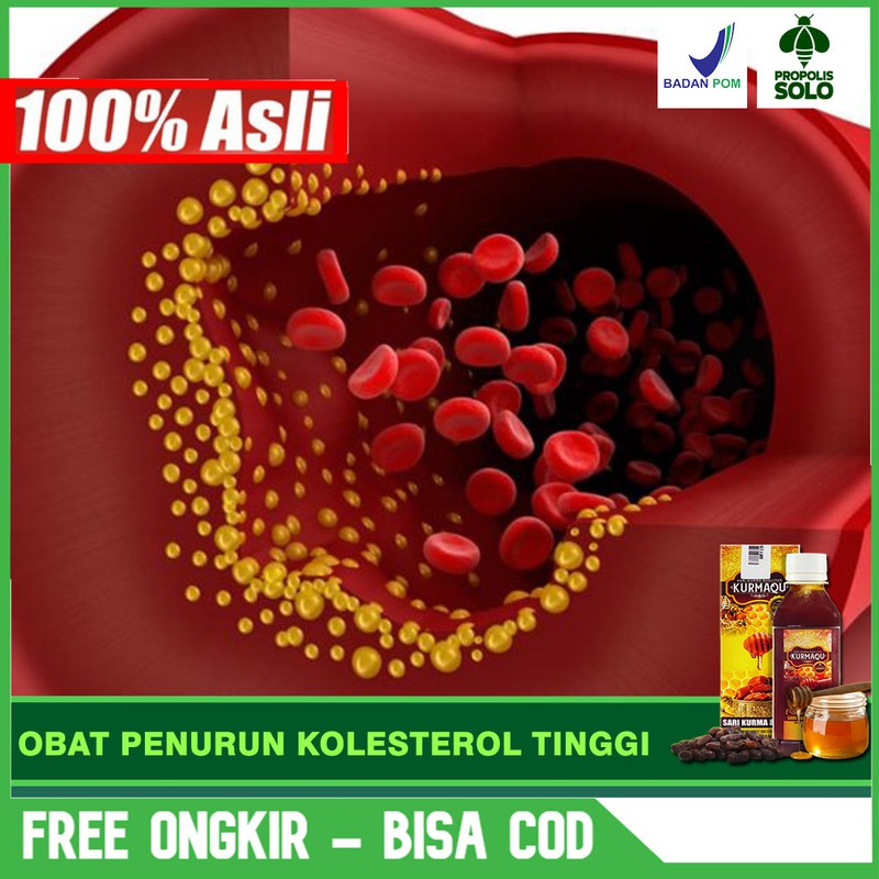 Obat Penurun Kolesterol Tinggi, Asam Urat Alami Terlaris Madu & Sari Kurma Di SOLO Bisa COD