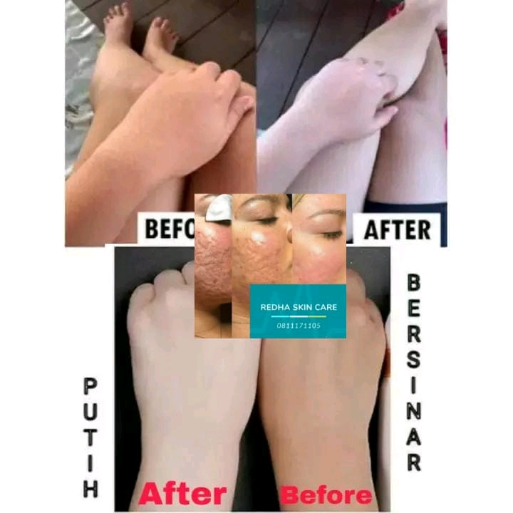 Bantalan Kaki Depan / Alas Busa Empuk Anti Slip / Insole Depan Impor / Sole Anti Pegal