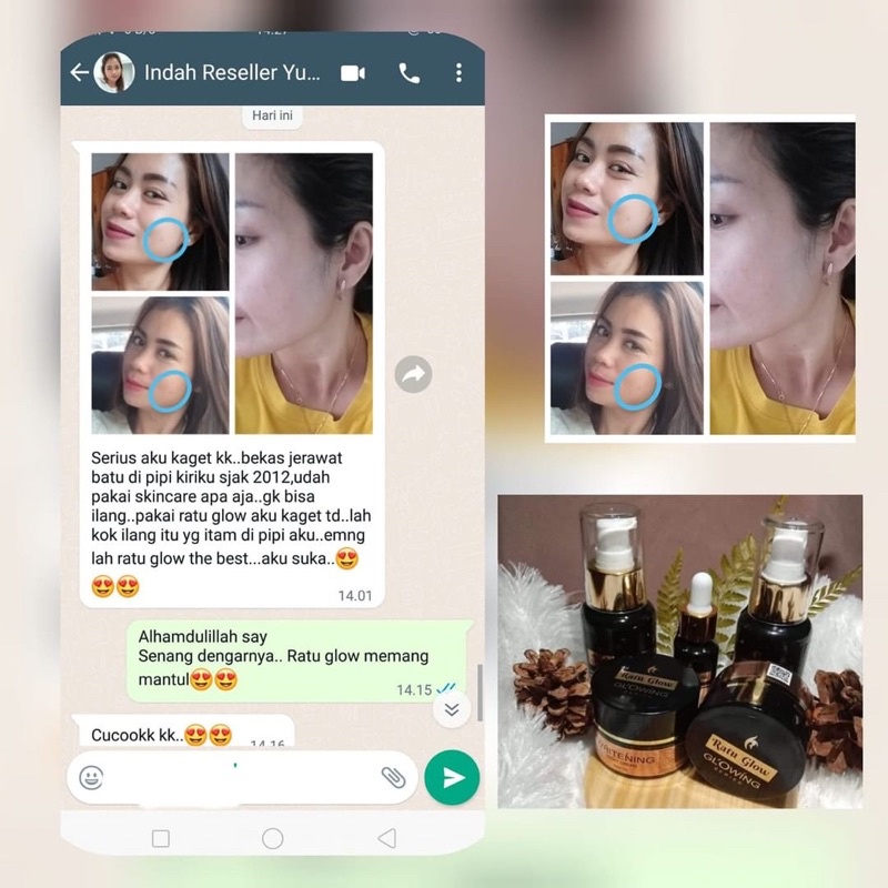 RATU GLOW PLATINUM SKINCARE BRIGHTENING ACNE PEMUTIH WAJAH PENGHILANG JERAWAT GLOWING ORIGINAL