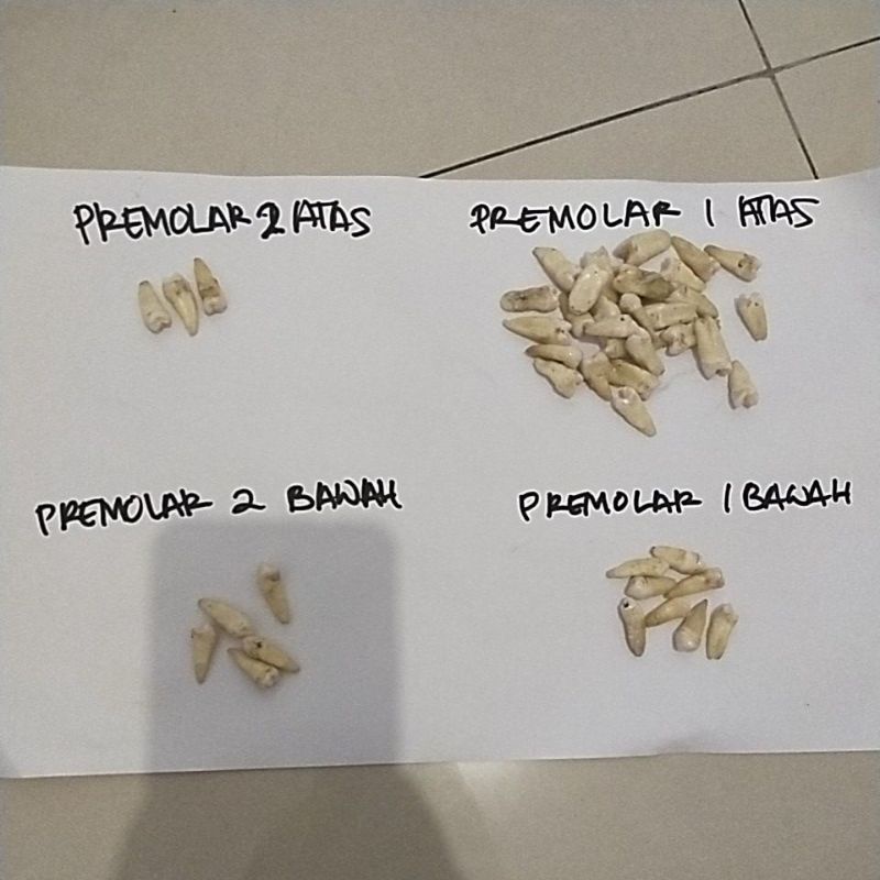 Gigi Asli Praktikum Gigi Anatomi Premolar