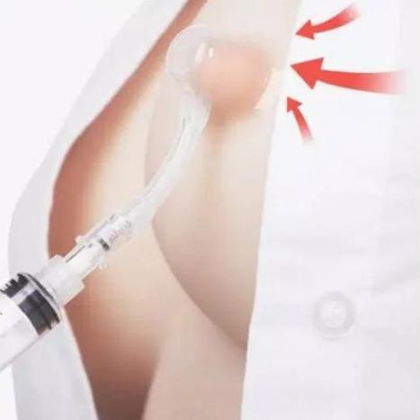 ➽ Nipple puller cup vakum alat penarik puting tenggelam ibu menyusui ◊