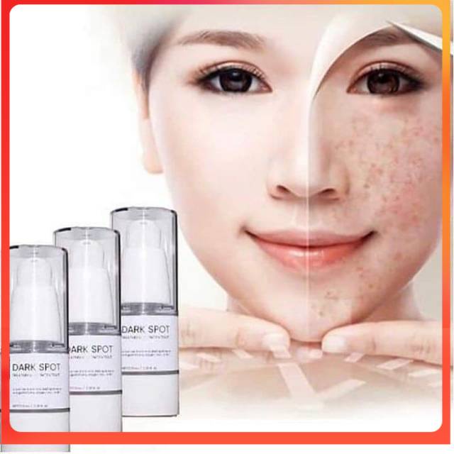 Ertos dark spot penghilang Flek hitam