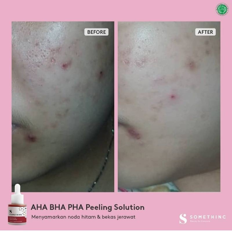 SOMETHINC SERUM 20ml AHA BHA / NIACINAMIDE / HYALURONIC  / BAKUCHIOL