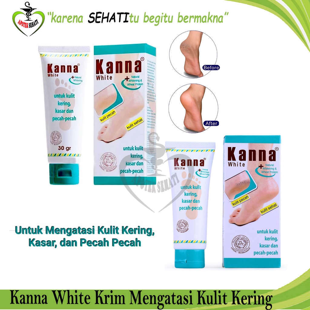 KANNA Soft Cream dan White Cream untuk Pelembab Kaki Pecah-Pecah Kanna Krim Kaki