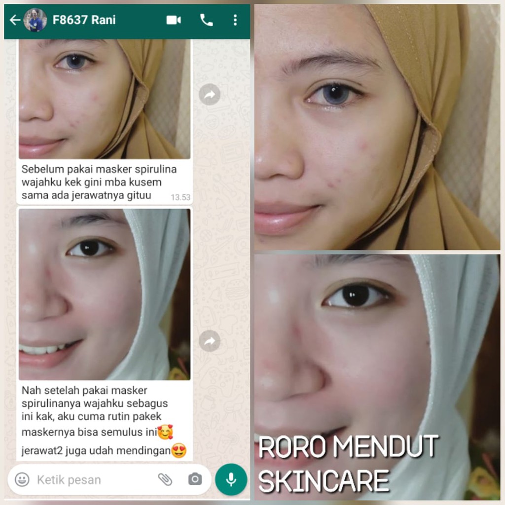 Roro Mendut Masker Spirulina Premium size 40 gr