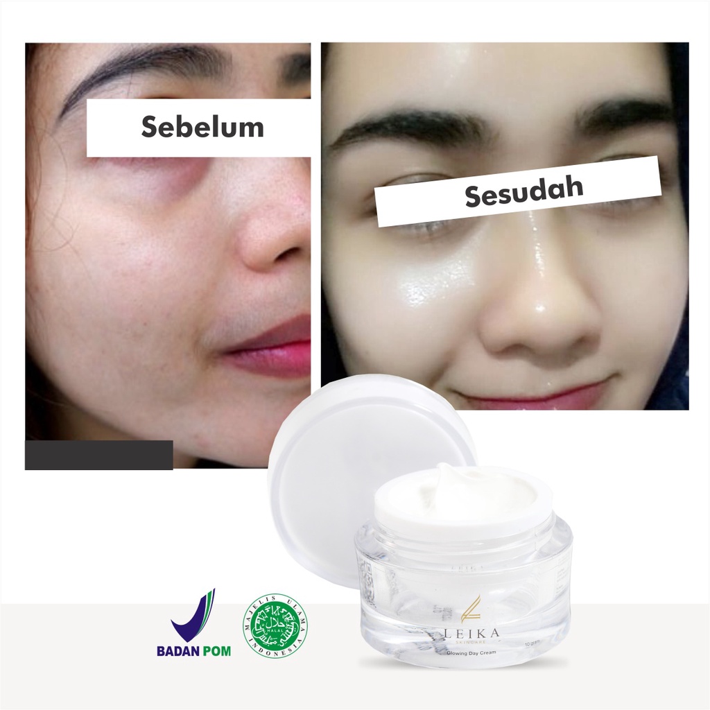 Glowing Putih Cepat! Krim untuk Kulit Wajah Glowing Putih Cepat Original BPOM Halal Murah Ampuh Cream Wajah Glowing Korea Asli Permanen Glowing Day Cream Leika Skincare 10gr Resmi BPOM