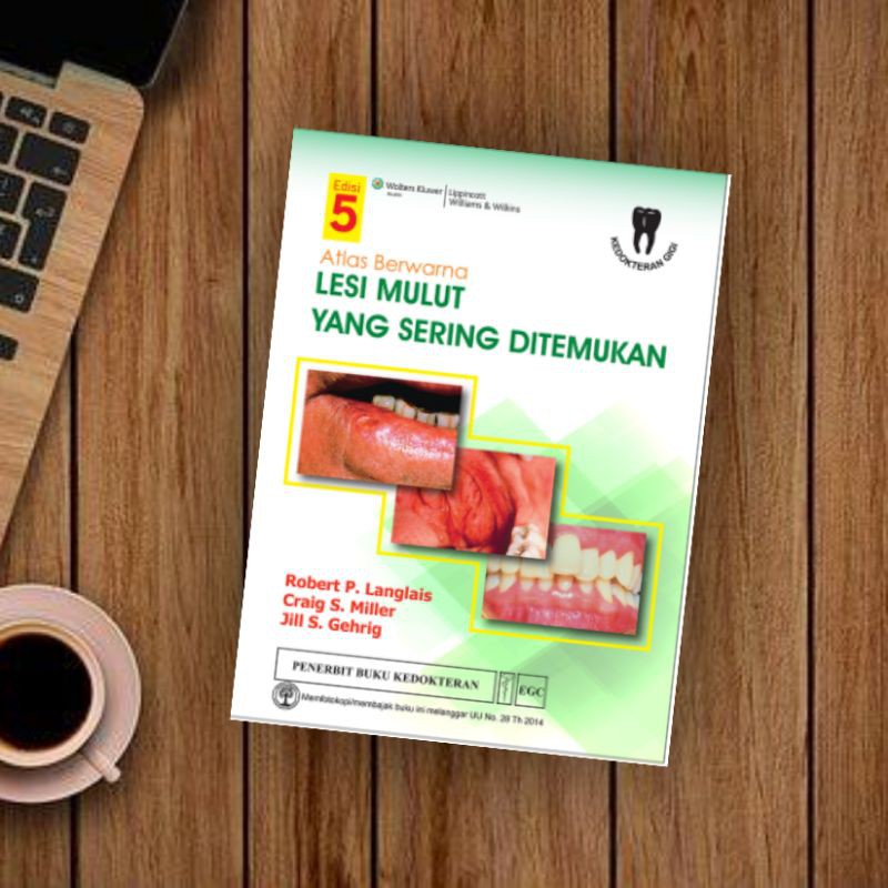 EGC BUKU KEDOKTERAN GIGI Atlas Berwarna Lesi Mulut yang Sering Ditemukan Ed.5 (EDISI TERBARU)