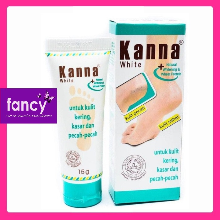 Kanna Krim Kaki 15 Gr 30gr Krim Kulit Kering Kasar Pecah2 Shopee Indonesia