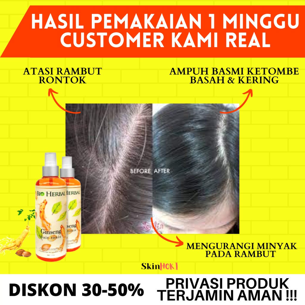 PENUMBUH RAMBUT BOTAK PENGHILANG RONTOK PAKET BIO HERBAL GINSENG SHAMPOO &amp; HAIR TONIC PERAWATAN RAMBUT ORIGINAL BPOM