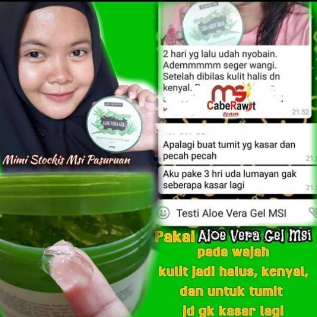 Msi Aloevera Gell 100 Ori Nature Republic Aloevera Gel Aloevera Aloeveramsi Shopee Indonesia